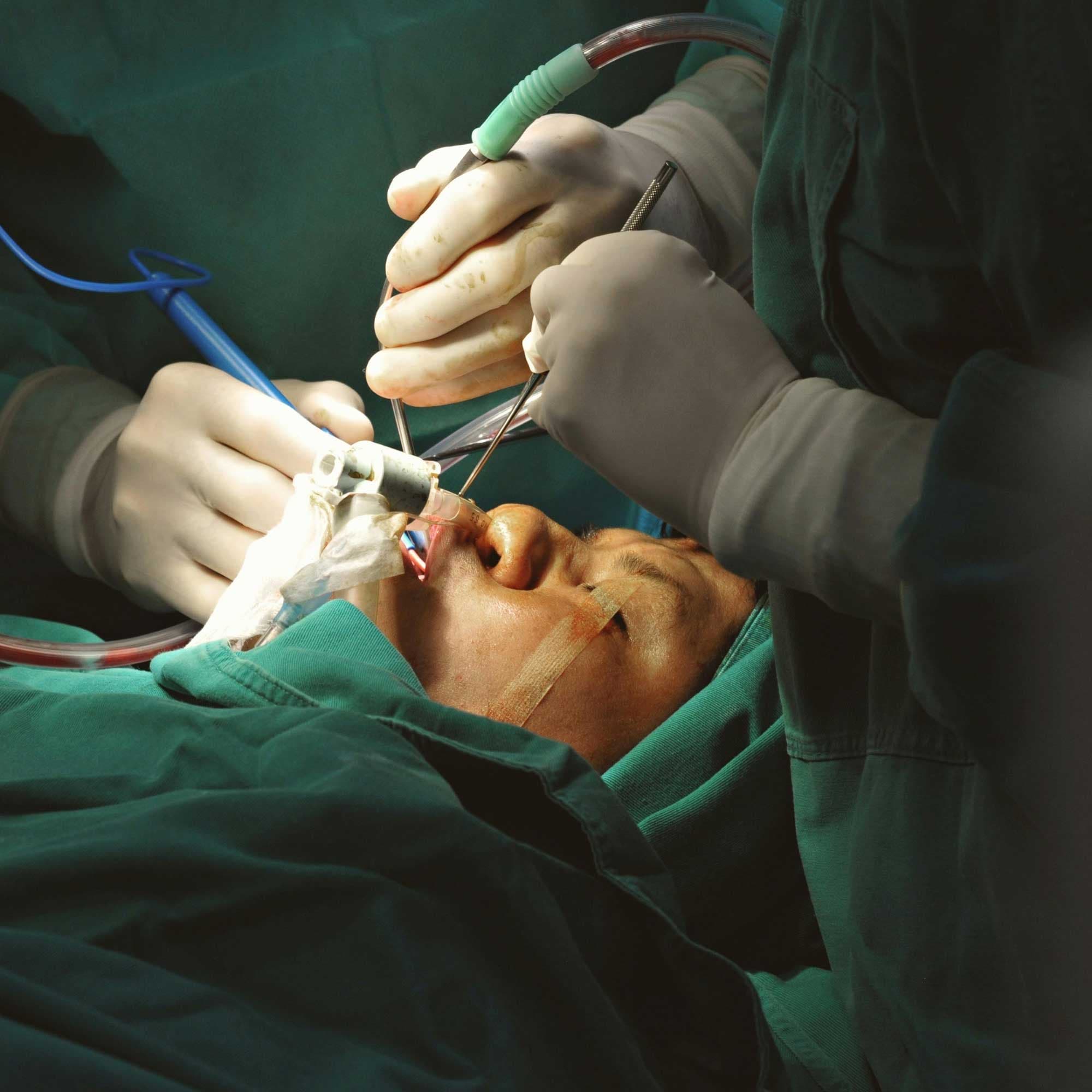 Cirurgias Odontológicas Avançadas