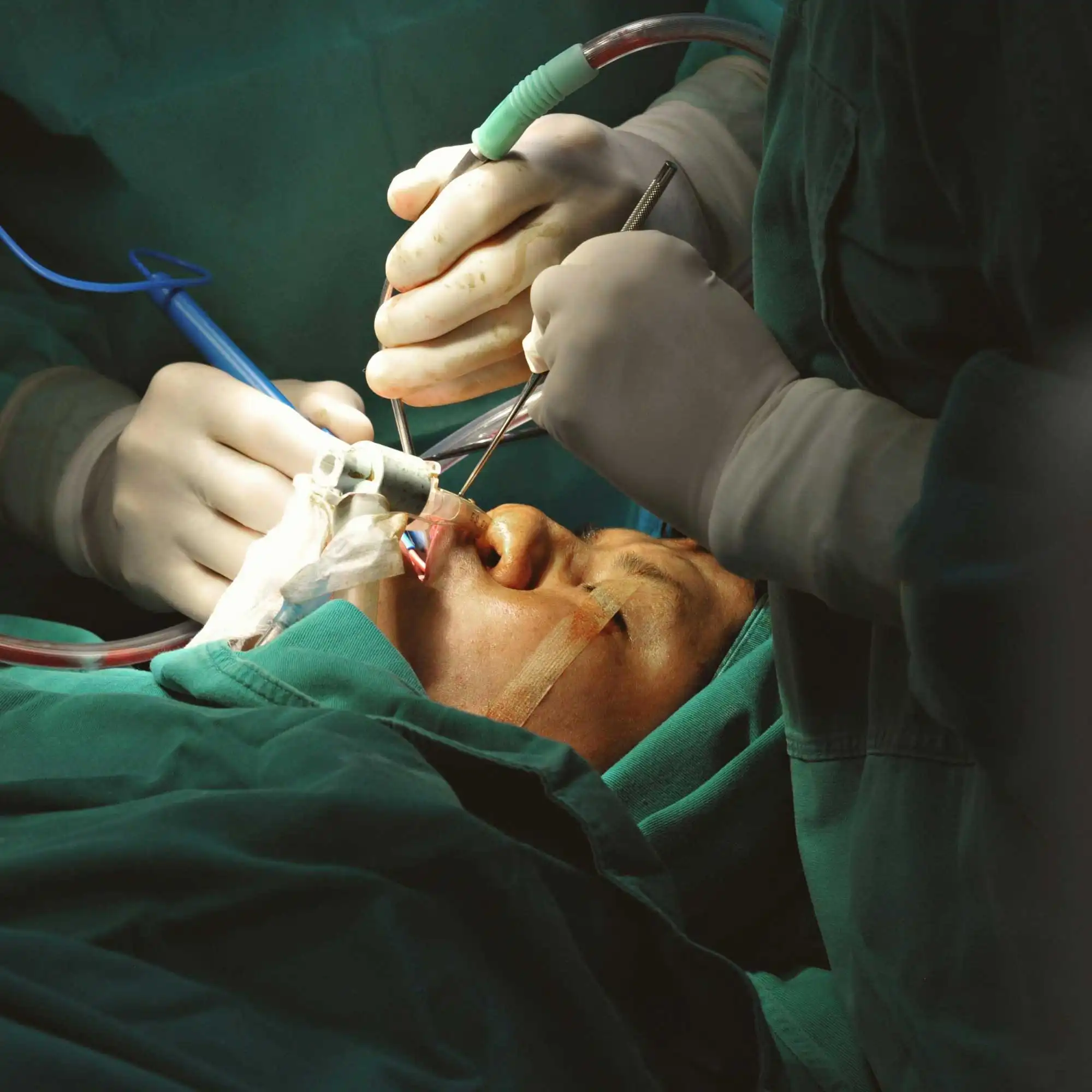 Cirurgias Odontológicas Avançadas Cirurgias Odontológicas Avançadas