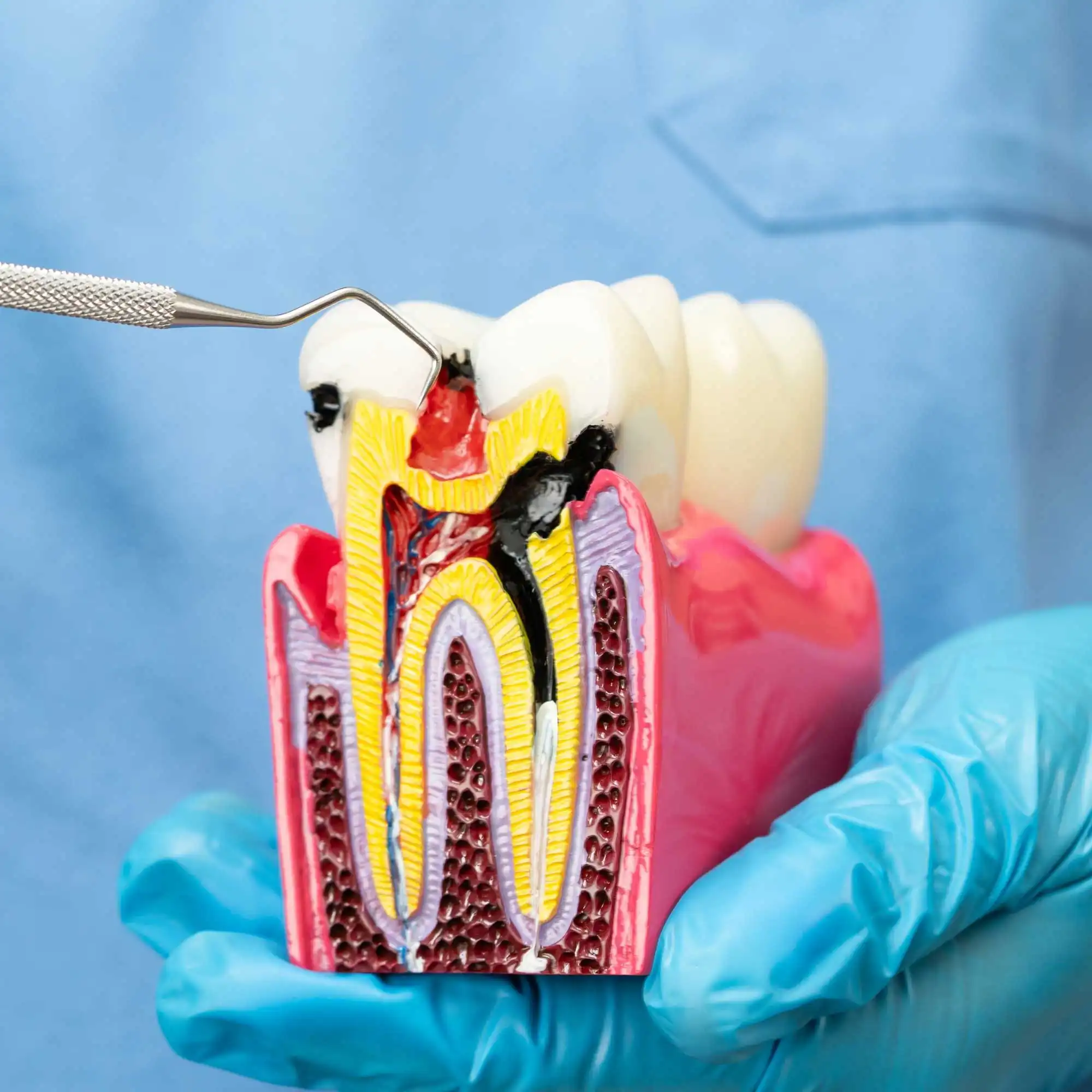 Tratamento de Sequelas Odontológicas Tratamento de Sequelas Odontológicas